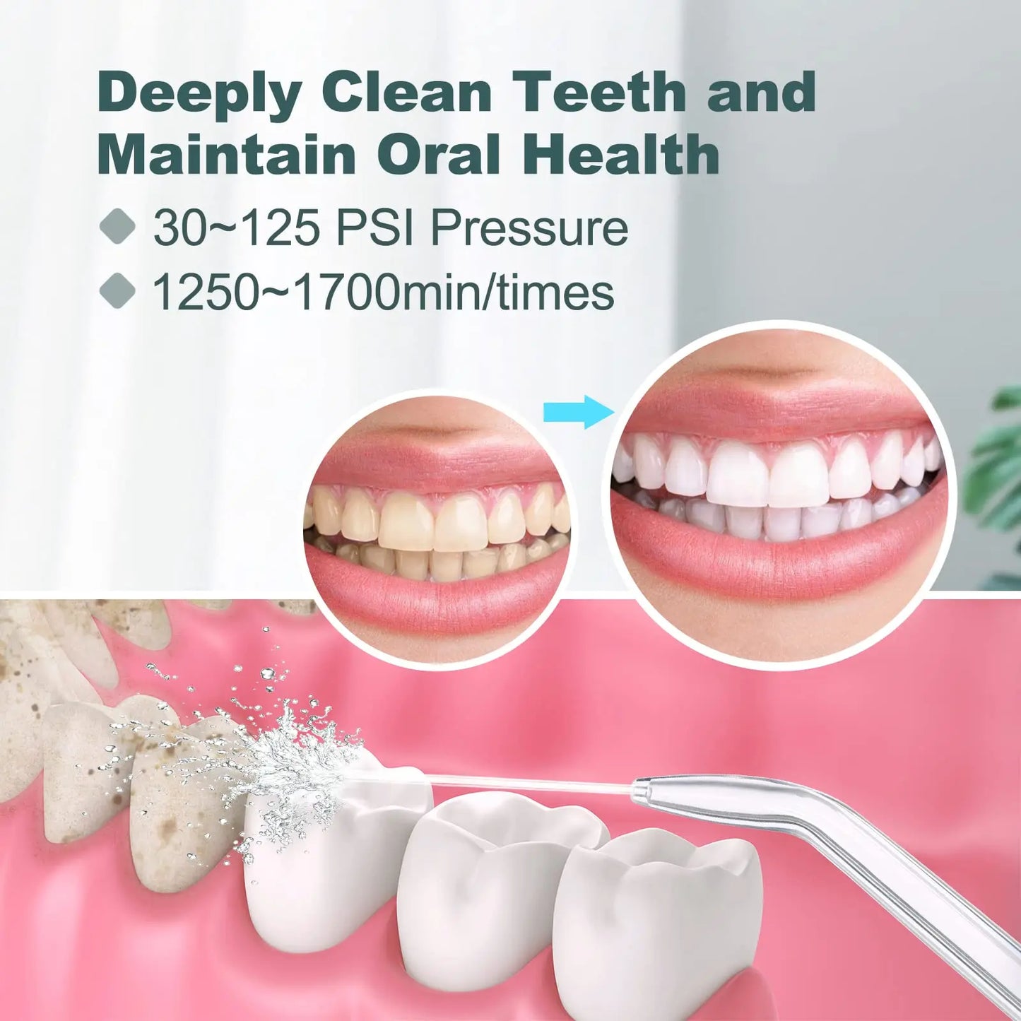 water flosser for Teeth \u0026 Braces Cleaning