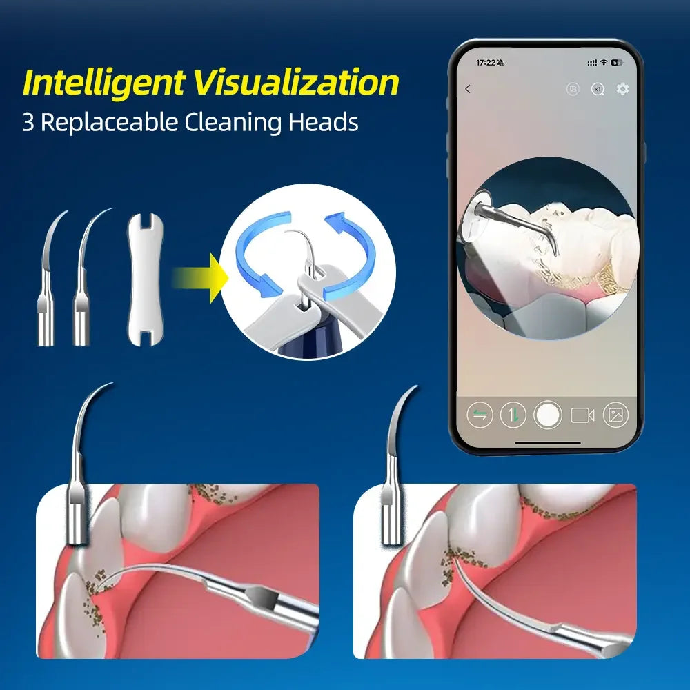 Electric Ultrasonic Dental Scaler For Teeth Tartar Plaque Stains Cleaner Tooth Calculus Electric Dental Tooth Stone Remover